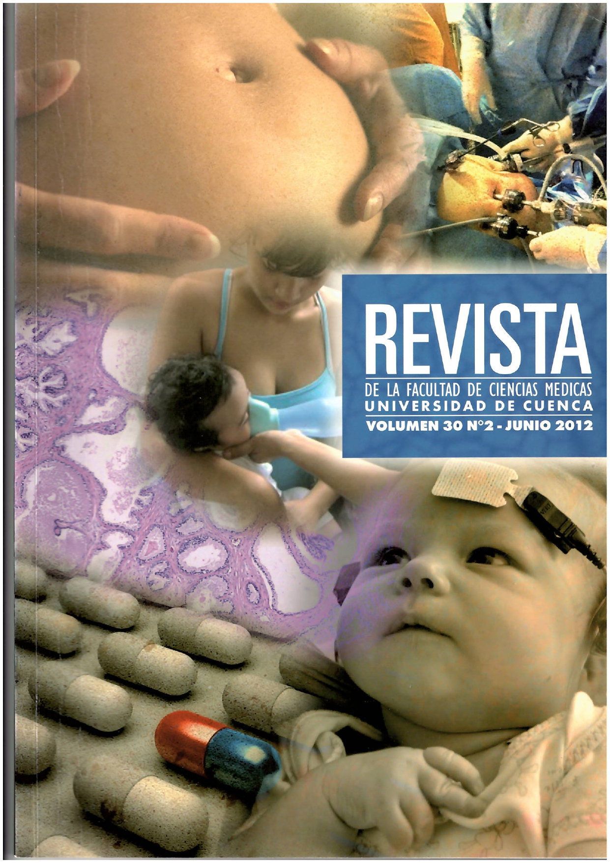 					Ver Vol. 30 Núm. 2 (2012): Revista de la Facultad de Ciencias Médicas de la Universidad de Cuenca
				